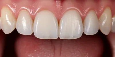 Illustration palatal - Image 1