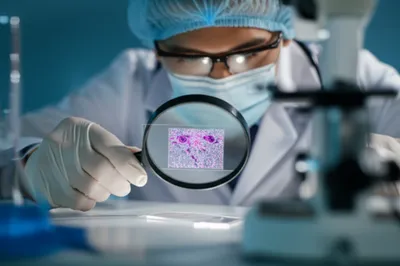 Illustration biopsy - Image 1