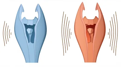 Illustration vocalise - Image 1