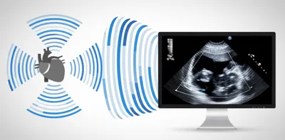 Illustration echoes - Image 1