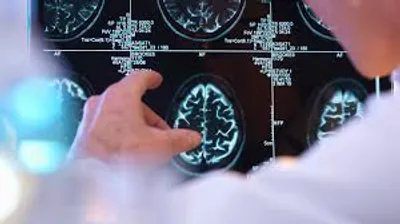 Illustration neurology - Image 2