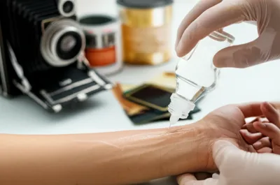 Illustration collodion