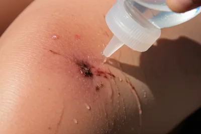 Illustration irrigated - Image 1