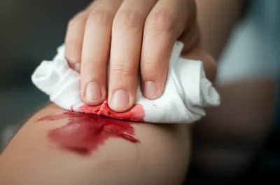 Illustration staunched - Image 1