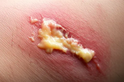 Hình ảnh minh họa digesting - Ảnh 1