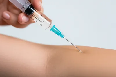 Illustration hypodermic