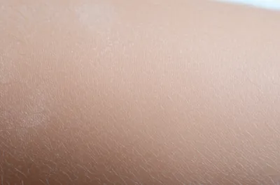 Illustration talcumed