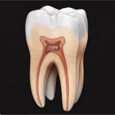 Illustration axial - Image 1