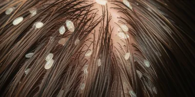 Illustration nits - Image 1