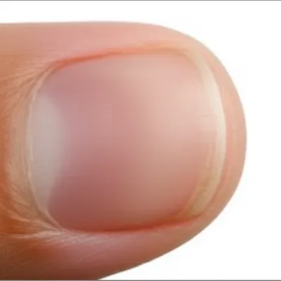 Illustration lunula - Image 1