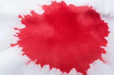 Illustration haemorrhaging