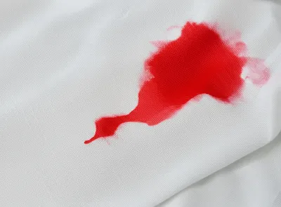 Illustration staining - Image 1