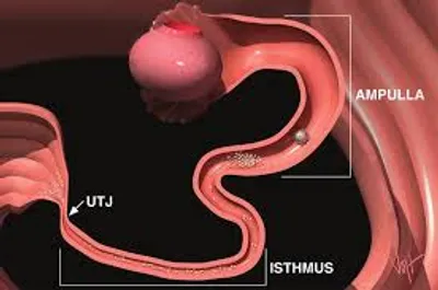 Illustration isthmus - Image 3