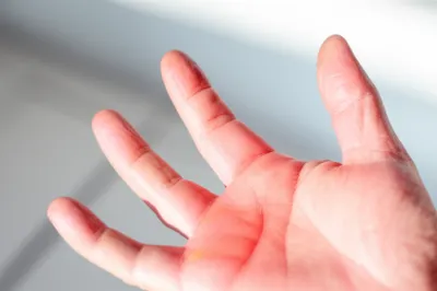 Illustration arthritic - Image 1