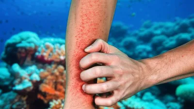 Illustration reef - Image 1