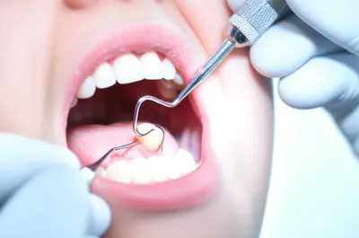 Illustration dentistry - Image 1