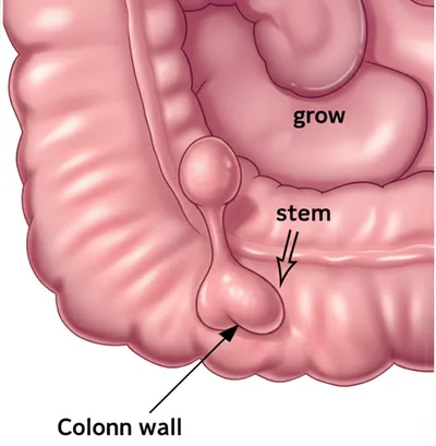 Illustration peduncle - Image 1