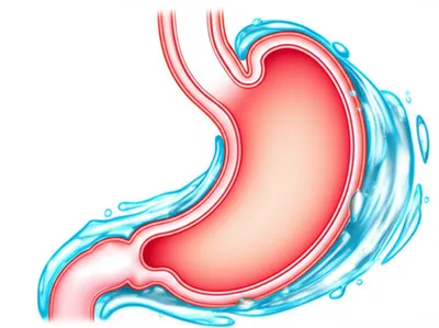 Illustration antacid - Image 1