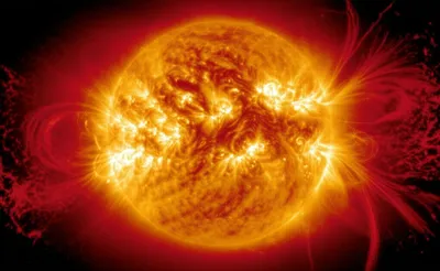 Illustration coronal - Image 1