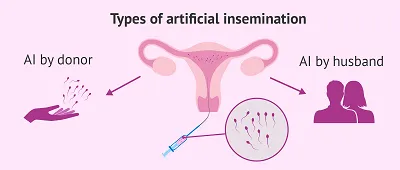 Illustration aid - Image 2