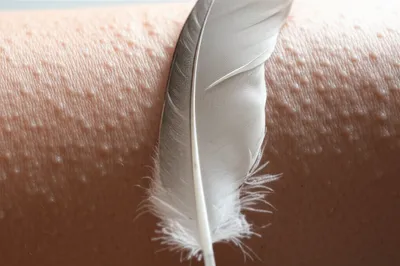 Illustration prickles - Image 1