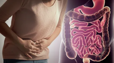 Illustration gripes - Image 1