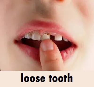 Illustration loose - Image 3