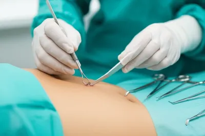 Illustration excavators - Image 1