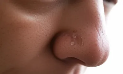 Illustration sniffling - Image 1