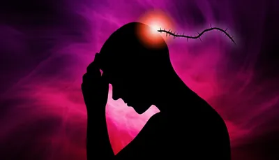 Illustration smarted - Image 1