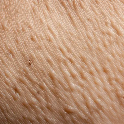 Illustration pock - Image 1