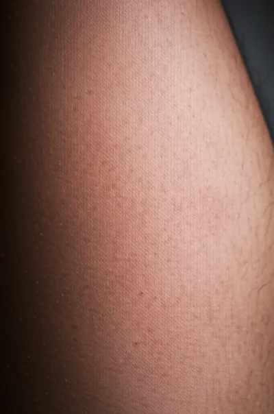 Illustration blotchy