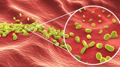 Illustration gonorrhea