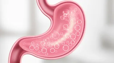 Illustration bloating - Image 1