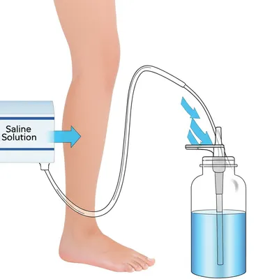 Illustration douches - Image 1