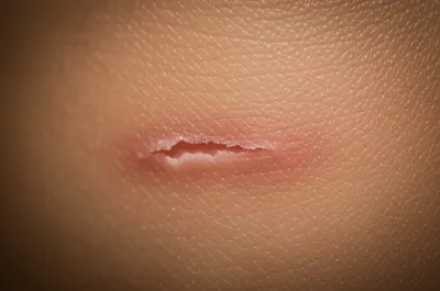 Illustration erosion - Image 1