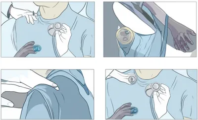 Illustration modalities - Image 1