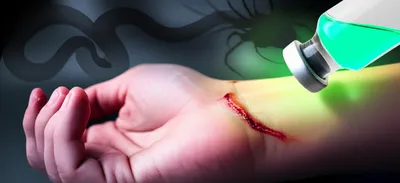 Illustration antivenin