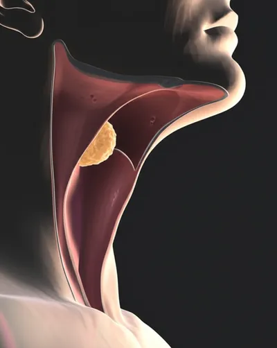 Illustration swallowing - Image 1