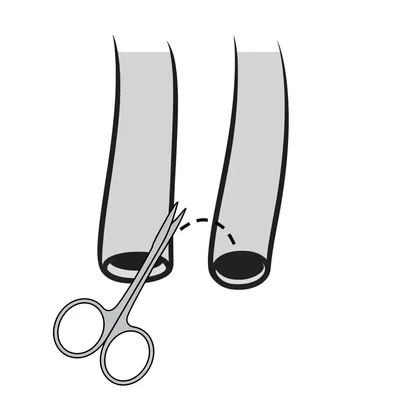 Illustration vasectomy