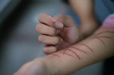 Illustration scratched - Image 1