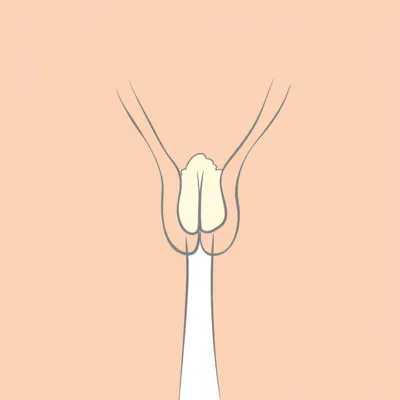 Illustration smegma - Image 1