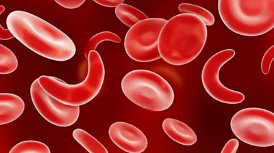 Illustration sickle - Image 1