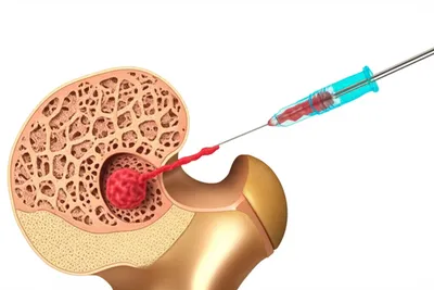 Illustration marrow - Image 1