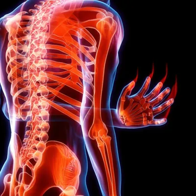 Illustration fit - Image 1