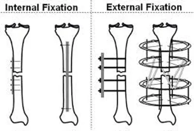Illustration fixation - Image 2