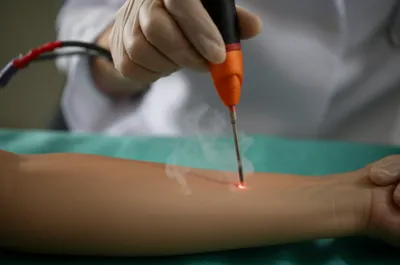 Illustration burnt - Image 1