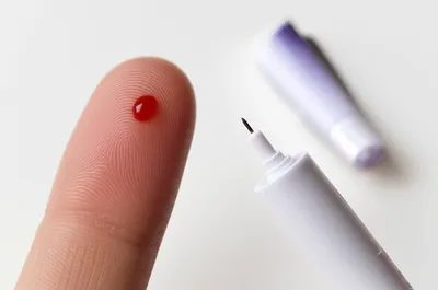 Illustration lancet - Image 1