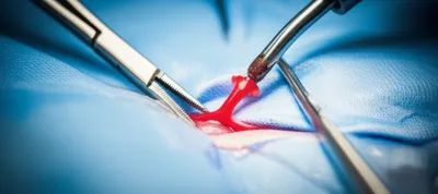 Illustration bleeder - Image 1