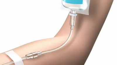 Illustration catheters